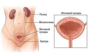 Инфекции мочевыводящих путей