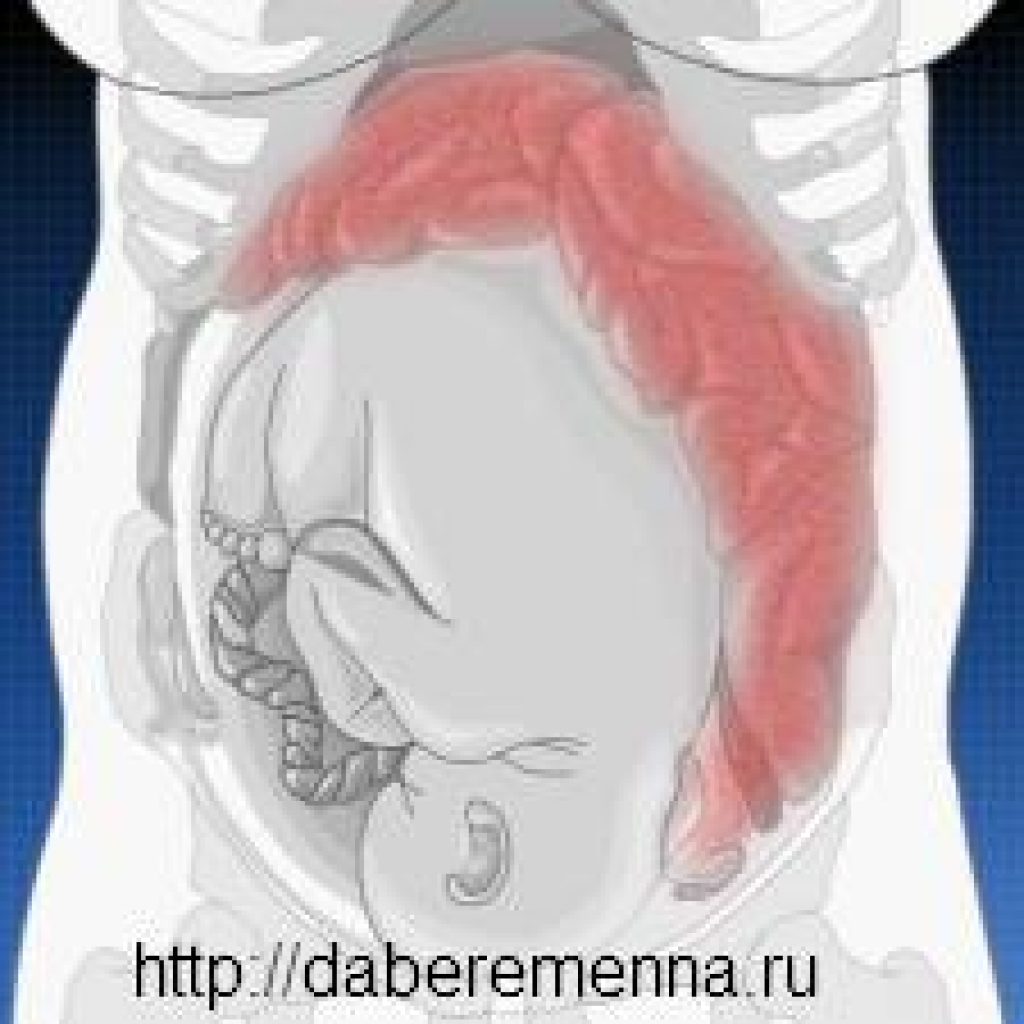 Запоры во время беременности