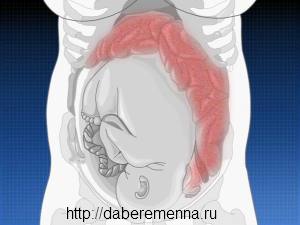 Запоры во время беременности